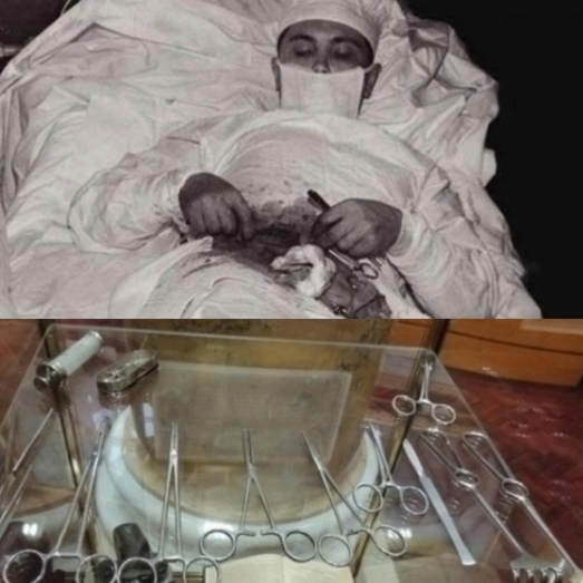 Үҙенә үҙе операция яһаған хирург